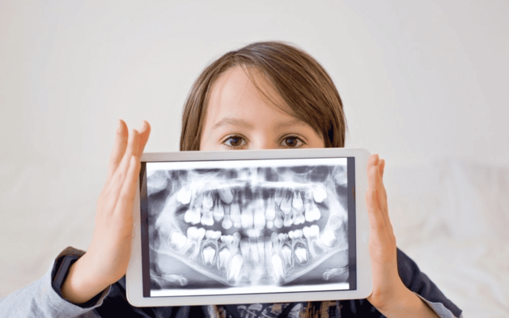 Why Dental X-Rays Are Important?