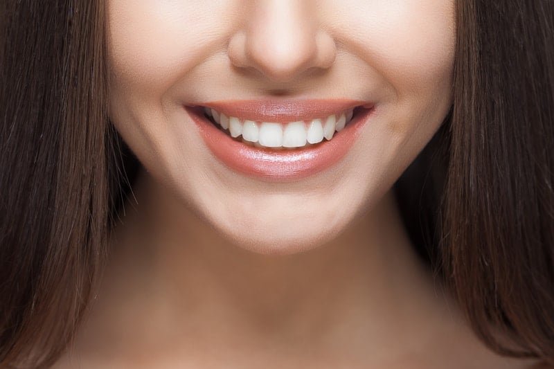 teeth Whitening best in lebanon